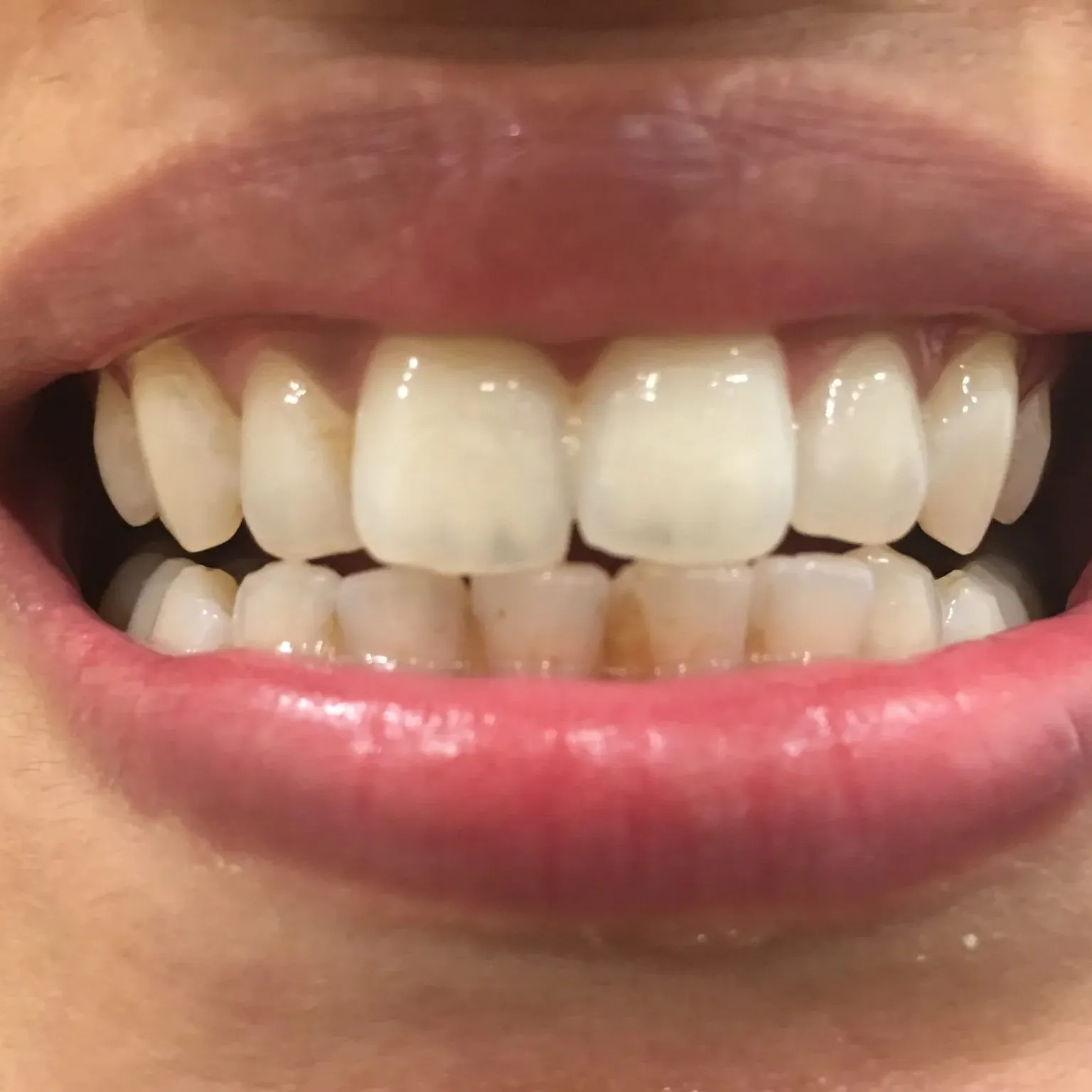 Dental Club